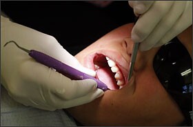 Aaron Shakelford, 11, has his teeth cleaned in the St. Mary’s Mobile Dental Health Clinic, which provides dental services to students regardless of insurance coverage through a partnership with the Evansville Vanderburgh school district.